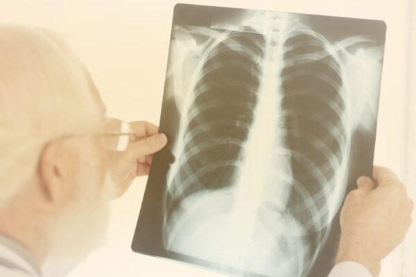 O perigo da tuberculose