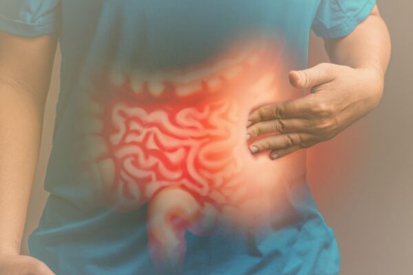 Câncer de intestino